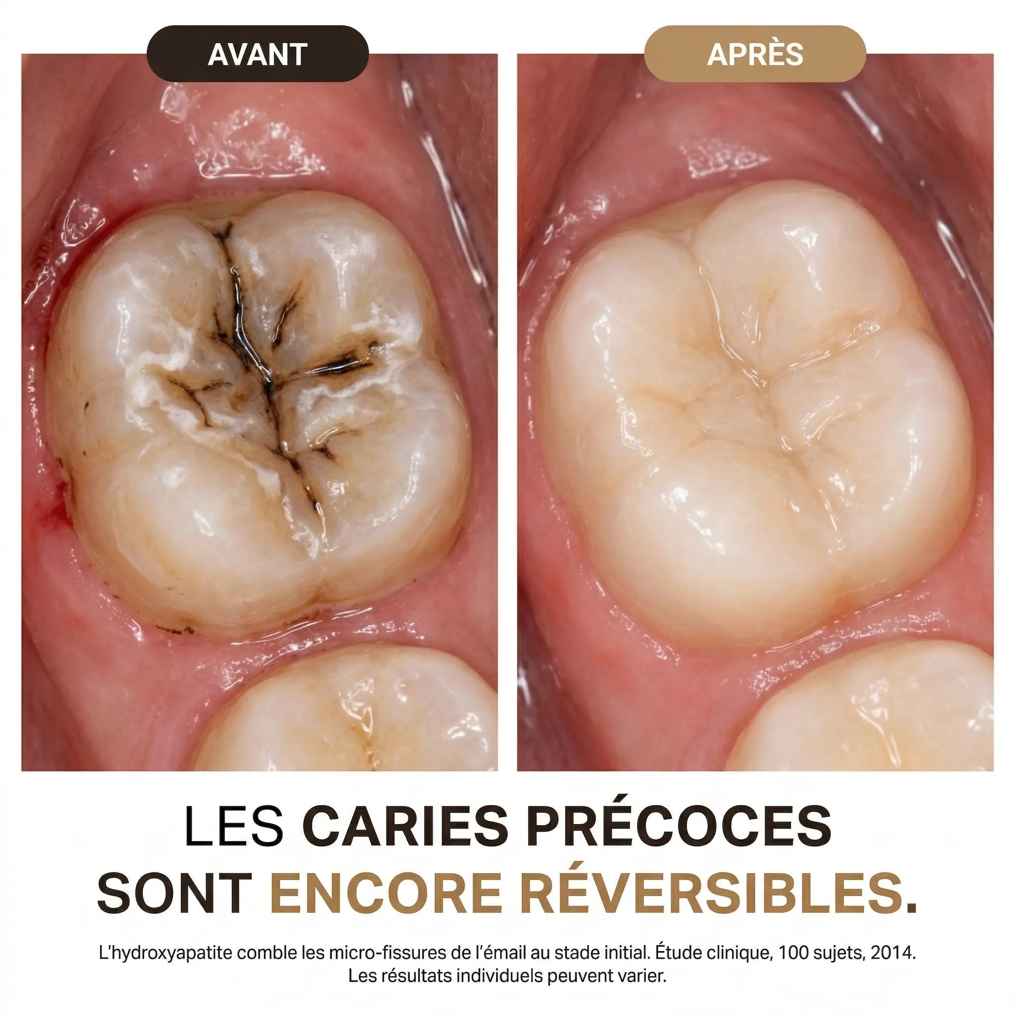 Fraîchemail™ — Chewing-gum reminéralisant